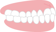 受け口の歯並び