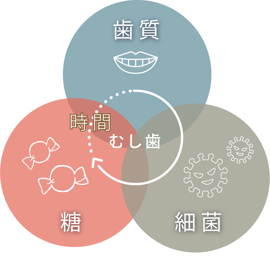 虫歯は歯質、細菌、糖に時間の経過が加わって発生する