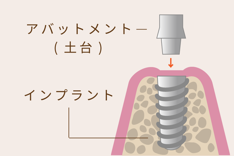 患者さんのお口の中を触る院長と、補助するスタッフ