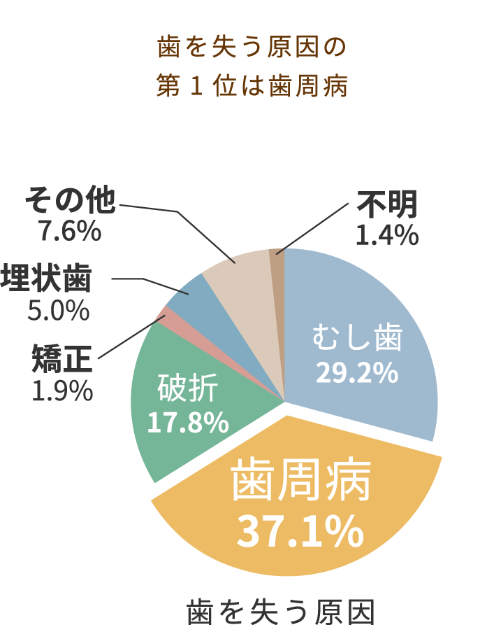 歯を失う原因第１位は歯周病、歯周病37.1%、虫歯29.2%、破折17.8％、埋伏歯5%、その他7.6%