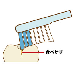 小児歯科