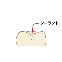 小児歯科